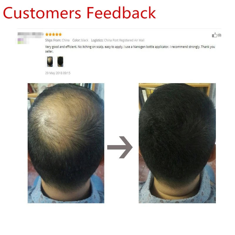 100g Hair Loss Building Hair Fibers Blender Conceal Styling Fiber Hair Powders Thinning Keratin Eyelash Extension Black