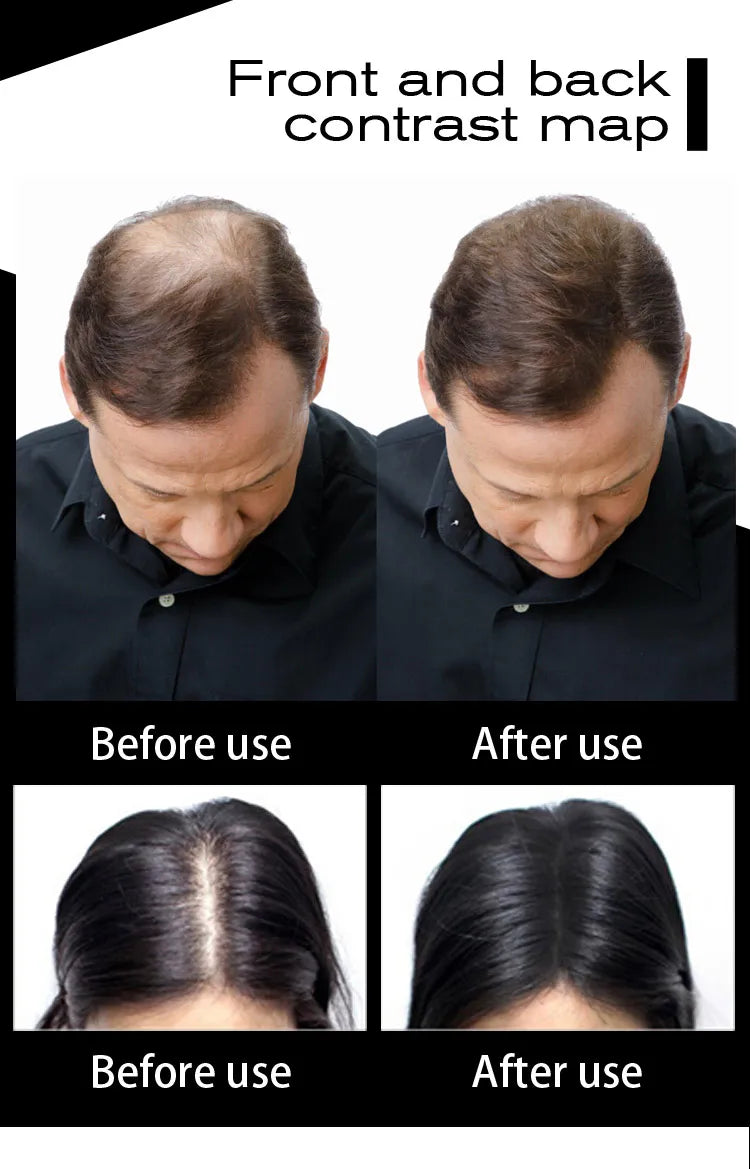 100g Hair Loss Building Hair Fibers Blender Conceal Styling Fiber Hair Powders Thinning Keratin Eyelash Extension Black