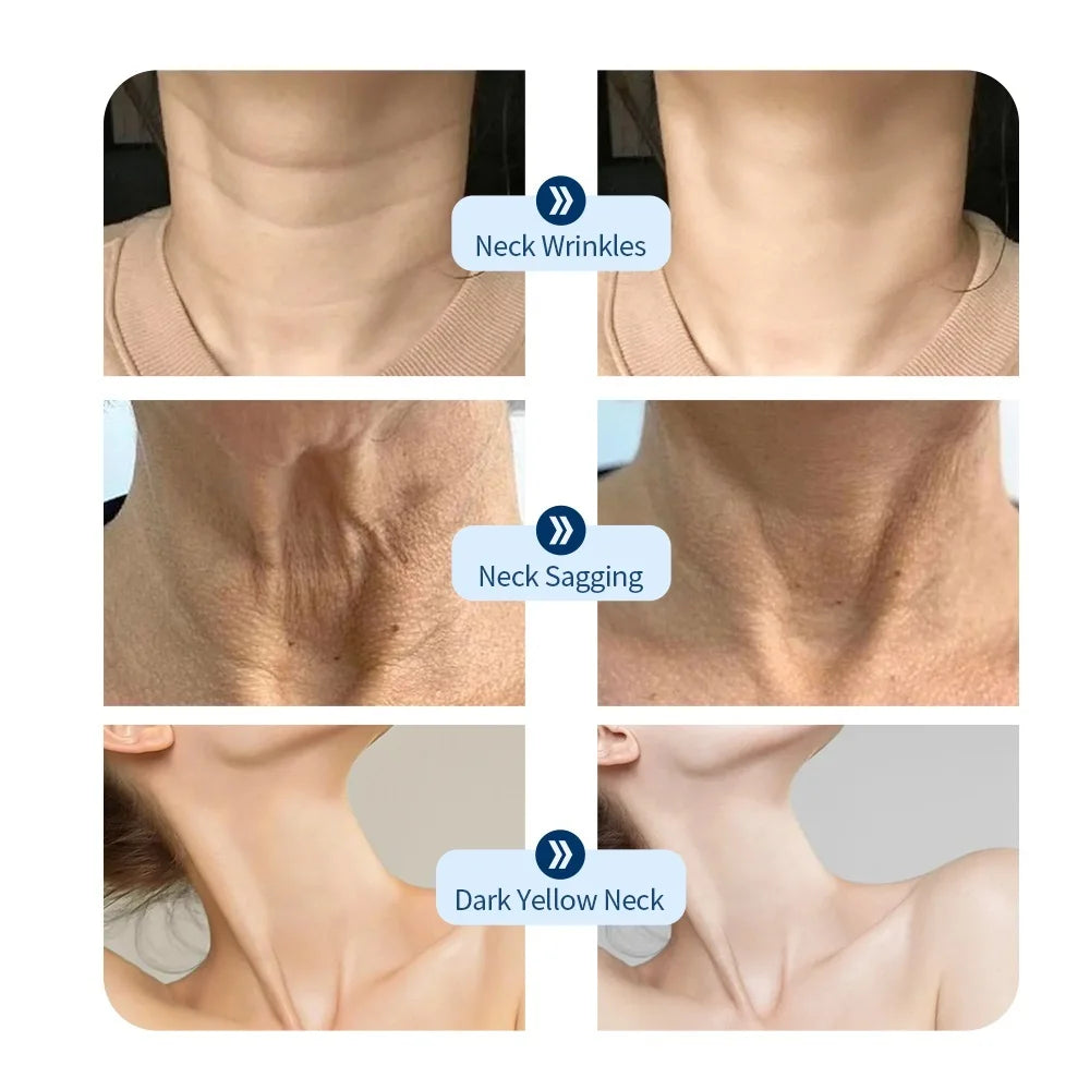 Neck LED Lift Mask Photon Anti-Wrinkle Skin Tightening Neck Beauty Device Skin Brighten Rejuvenation Neck Wrinkle Remover